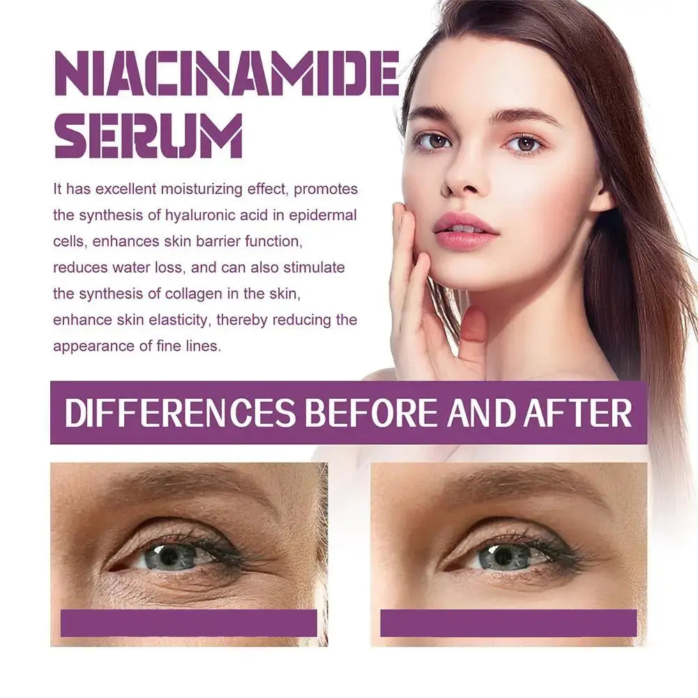 20% Niacinamide B3 Concentrated Serum for -Aging, Minimizing Large Pores & Discoloration, -Free, 0.67 Ounce Skin Care Blemish Isra