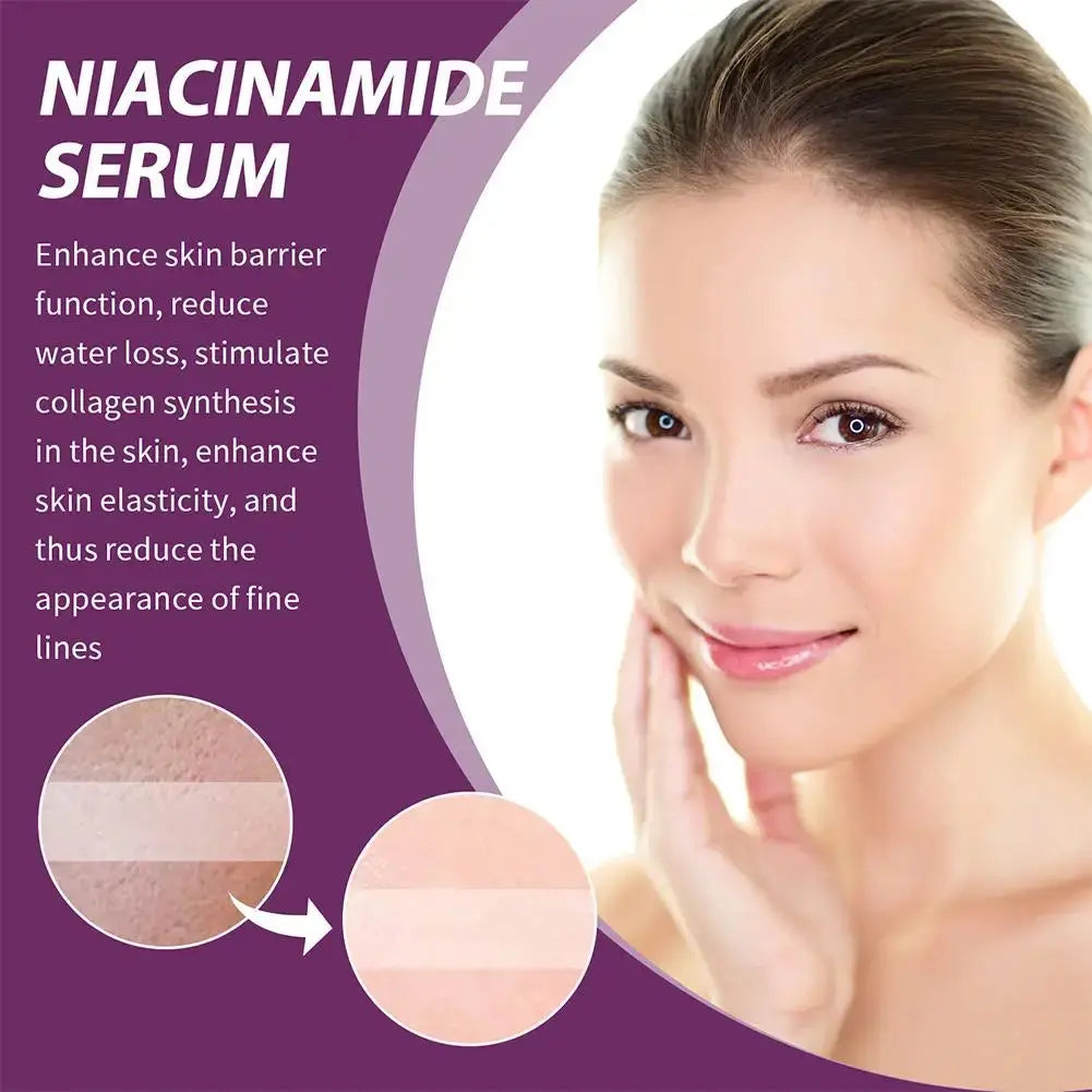 20% Niacinamide B3 Concentrated Serum for -Aging, Minimizing Large Pores & Discoloration, -Free, 0.67 Ounce Skin Care Blemish Isra