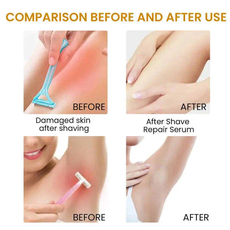 Bikini Area Hair Serum for Irritation Relief and Smooth Skin Isra