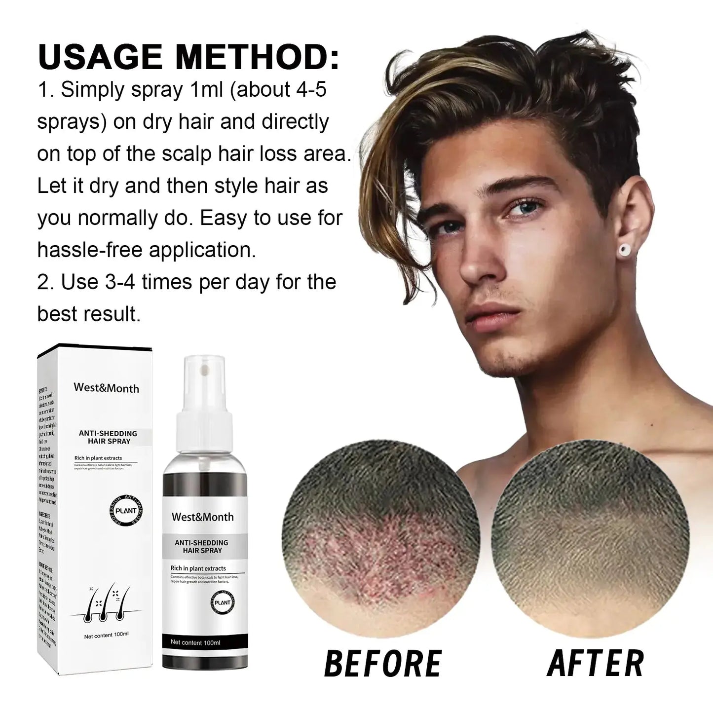 West & Month Hair Growth Spray for Nourishing Roots Isra
