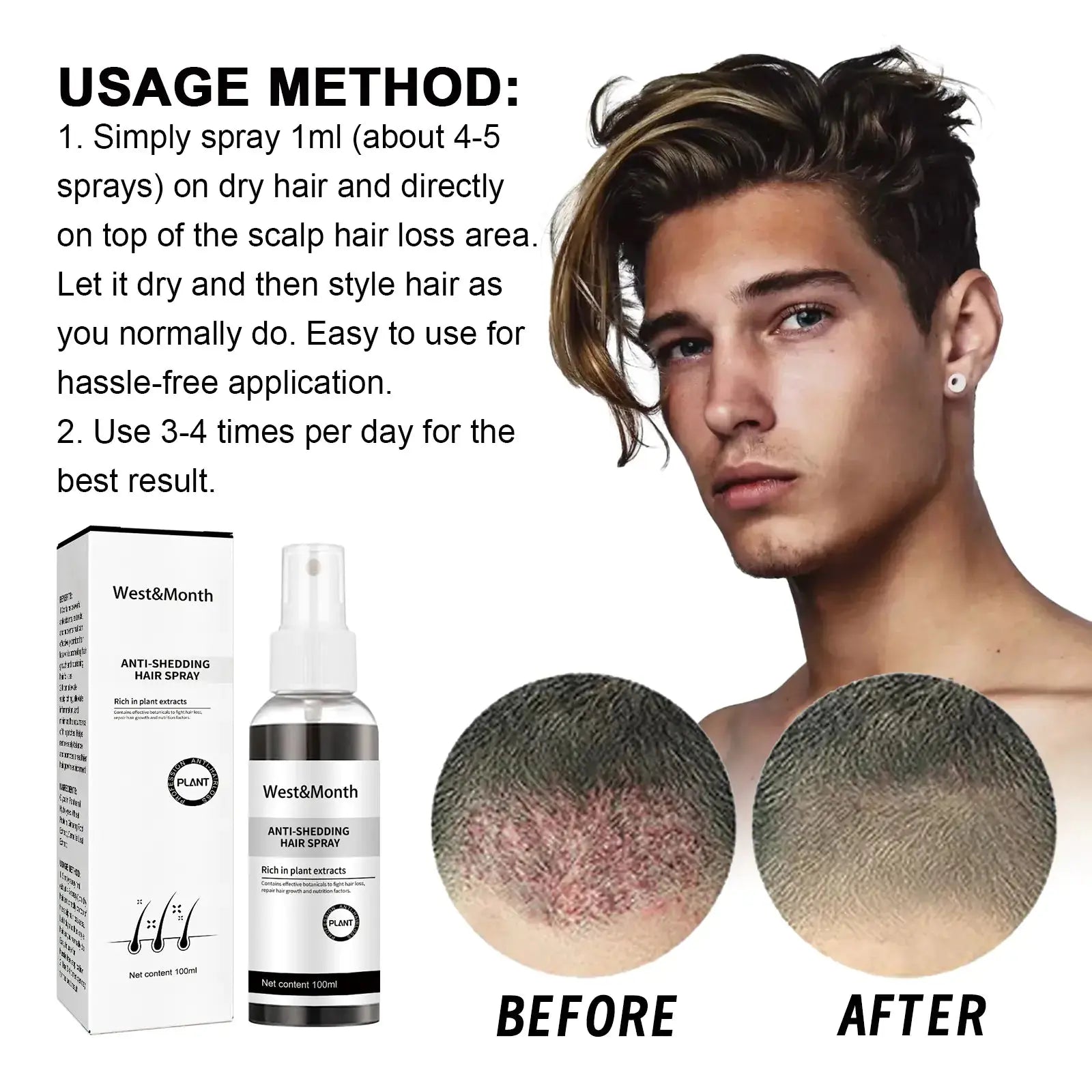 West & Month Hair Growth Spray for Nourishing Roots Isra