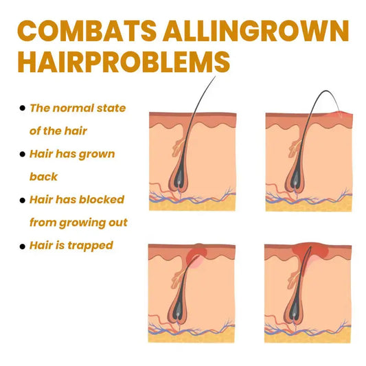 Bikini Area Hair Serum for Irritation Relief and Smooth Skin Isra